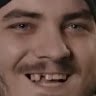 faryx4