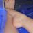 Brdn91