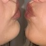 KissMaster